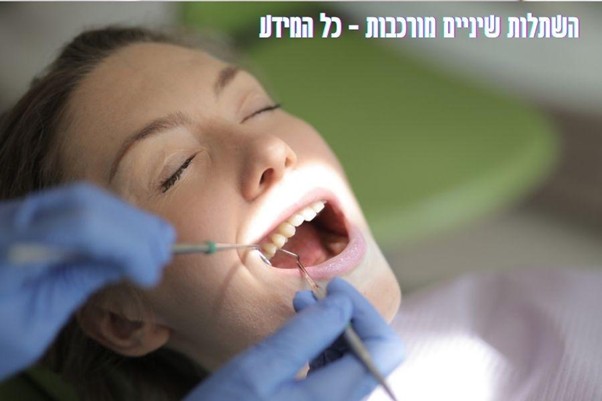 השתלות שיניים מורכבות